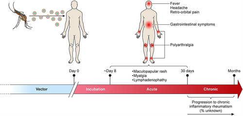 Figure 4. Clinical manifestation of ONNV infection. Diagram showing the general disease progression of ONNV. After being bitten, the virus typically takes ~8 days before the patient becomes symptomatic. This progresses to the acute phase (days 8–15) with generalised symptoms such as fever, rashes, and headaches. In rare cases, ONNV infections will cause lymphoedema and retro-orbital pain, joint pain might also begin to manifest during this time. If not self-limiting, the disease will progress to enhanced pain and inflammation in the joints (targeting extremities) which in rare cases can last for several months (chronic phase).