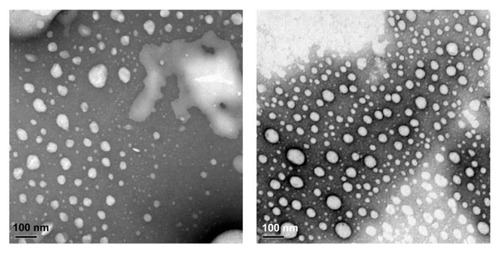 Figure 2 Transmission electron micrographs of liposomes. TRAIL liposomes (left), ActD liposomes (right).Note: Bar = 100 nm.Abbreviations: TRAIL, tumor necrosis factor-related apoptosis-inducing ligand; ActD, actinomycin D.