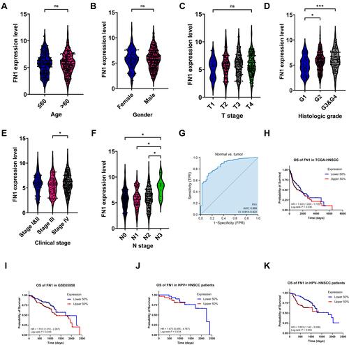 Figure 2 High expression of FN1 predicted advanced malignancy and poor prognosis in patients with HNSCC. (A–F) Relationship between FN1 expression and age, gender, T stage, histologic grade, clinical stage, and N stage of HNSCC patients. (G) Diagnostic value of FN1 in HNSCC. (H) OS of FN1 in HNSCC patients from TCGA. (I) OS of FN1 in HNSCC patients from GSE65858. (J) OS of FN1 in HPV+ HNSCC patients from GSE65858. (K) OS of FN1 in HPV- HNSCC patients from GSE65858. The results are presented as the mean ± SD. *P < 0.05, ***P < 0.001.