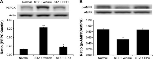 Figure 6 EPO-induced changes of PEPCK expression (A) and AMPK phosphorylation (B) in the liver of type 1-like diabetic rats.