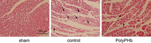 Figure 3. Representative photomicrographs of HE-stained left ventricular tissue sections. Magnification × 400, scale bar: 100 μm. Arrows indicate the locations of acute myocardial necrosis, cellular swelling, or fatty changes (n = 5).
