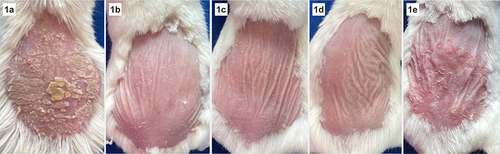 Figure 1 Clinical image of skin lesion after treatment. (a) Group I, psoriasis control group (5% imiquimod cream), Modified PASI 6. (b) Group C1 (5% imiquimod cream followed by a mixture of Ciplukan and vaseline in a 1:2 ratio), Modified PASI 1. (c) Group C2 (5% imiquimod cream followed by a mixture of Ciplukan and vaseline in a 1:4 ratio), Modified PASI 1. (d) Group M (5% imiquimod cream followed by mometasone furoate cream), Modified PASI 1. (e) Group V, vehicle group (5% imiquimod cream followed by vaselin album), Modified PASI 4.