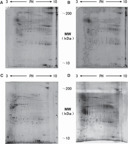 Figure 2. Representative 2-D gel analyses of NMPs from (A) normal breast, (B) hyperplastic mammary, (C) atypical epithelial hyperplasia and (D) breast carcinoma.