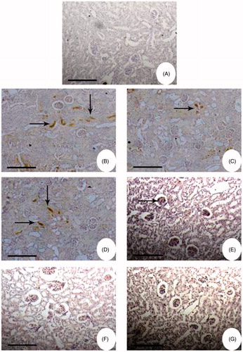 Figure 8. Immunohistochemistry of NF-κB in kidney of Wistar rats. Bright field photomicrographs show kidney sections from: (A) Physiological saline-injected rat (group I); (B) the animals administered with glycerol alone (group II); (C) the animals were administered with glycerol simultaneously treated with 5 mg/kg body weight FA; (D) the animals were administered with glycerol simultaneously treated with 10 mg/kg body weight FA; (E) the animals were administered with glycerol simultaneously treated with 15 mg/kg body weight FA; (F) the animals were administered with glycerol simultaneously treated with 20 mg/kg body weight FA; (G) the animals were administered with glycerol simultaneously treated with 25 mg/kg body weight FA. Kidney sections were preincubated with rabbit polyclonal IgG to rat NF-κB (1:500 dilution) and subsequently with goat anti-rabbit IgG-HRP conjugate (1:3000 dilution). The immunoreactivity was developed with 0.01% DAB and 2% H2O2.