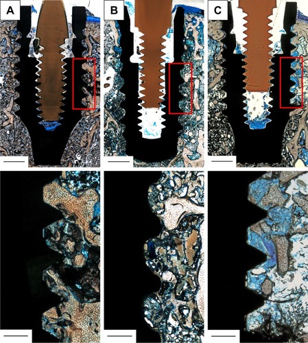 Figure 1 Histological samples, stained with toluidine blue, including reference boxes (red squares) (top) and zoom-in of these (bottom).Notes: Reference box marks the standard area employed to evaluate new bone formation, which was used to calculate the percentage of de novo bone synthesis in defined distances from the implant interface with regions of interest I (0–250 µm) and II (250–500 µm) with respect to the total reference area. The part of the implant surface defined by the reference was also used to evaluate the percentage of direct bone-to-implant contact with respect to the total length of the reference box: (A) Ti-Sr-O; (B) SLActive; and (C) Ti. The PEEK guiding pin is clearly identified as the brown, screw-shaped structure in the internal geometry of the implant. Scale bar is 1,000 µm in the upper total section and 250 µm in the lower zoomed-in segment.Abbreviations: Ti-Sr-O, strontium-functionalized surface; PEEK, polyetheretherketone.