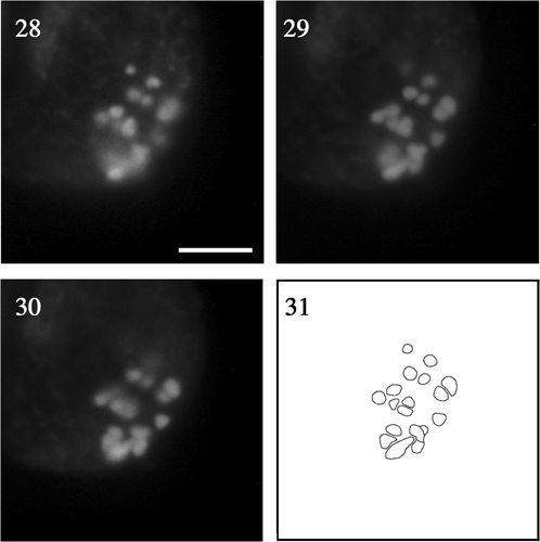 Figs 28–31. Fluorescence micrographs of chromosomes at meiotic diakinesis at different focal planes of the same zygote. Fig. 28. Low. Fig. 29. Middle. Fig. 30. Upper. Fig. 31. Composite image based on the superimposition of views Figs 28–30. Scale bar: 5 µm.