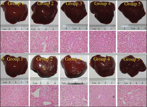 Figure 6. The effects of LP and LBPs on the histopathological profiles of mice livers in the preventive (a) and therapeutic (b) trials. The meaning of each group in both the trials was the same as that in Figure 3.Figura 6. Efectos del LP y los LBP en los perfiles histopatológicos de los hígados de ratones durante los ensayos preventivo (a) y terapéutico (b). El significado de cada grupo en ambos ensayos es el mismo que el mostrado en la Figura 3.