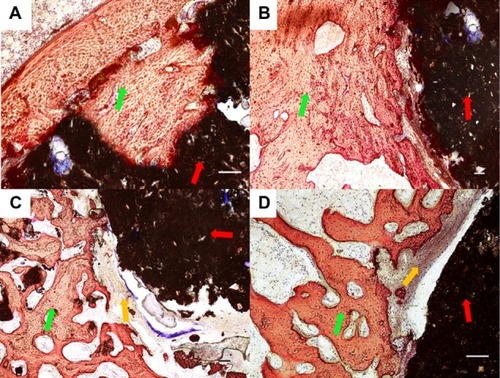 Figure 9 Histological morphologies after implantation at 12 weeks. (A) The 1:1 P/L ratio of CPC–FG; (B) 3:1 P/L ratio of CPC–FG; (C) 5:1 P/L ratio of CPC–FG; (D) pure CPC.