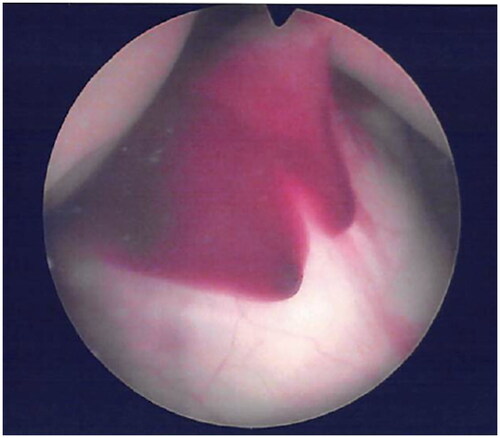 Figure 3. Endoscopic view of the cardiocenteses sites.