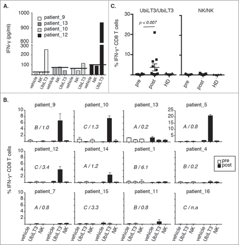 Figure 2. UbiLT3 DRibble-specific CD8+ T cell responses in post GVAX PBMC. 2A. IFN-γ responses determined by CBA in supernatants of post-GVAX PBMC samples from four patients harvested after 40 hours ex vivo stimulation with vehicle, NK DRibbles (NK) or UbiLT3 DRibbles (UbiLT3). PSA-DT increases or decreases are depicted. 2B. Shown are the percentages of IFN-γ producing CD8+ T cells in 12 patients after 1 week in vitro stimulation of pre- (white bars) and post- (black bars) PBMC. Primary stimuli are as depicted on the x-axis and the secondary stimulus was 20 μg/ml UbiLT3 DRibbles. Duplicate wells were measured for each condition. The different treatment arms (A,B,C) and the ratio in PSA-DT are indicated in the graphs. N.a. = not available. 2C. Combined CD8+ IFN-γ responses for UbiLT3- (left) and NK DRibble prime/boost (right) for all patients (n = 12) and healthy donors (HD) (n = 6) tested. A 2-tailed Wilcoxin signed rank test was performed to determine a significant difference in response between pre-and post PBMC (p < 0.007).