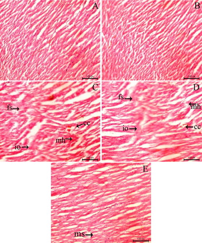 Figure 4. Histopathology of heart tissue: histopathological changes occurred in rat heart tissues after As2O3 administration and its amelioration with FSO treatment (Hematoxylin and Eosin, 100×). (a) – normal control; (b) – FSO (500 mg/kg b.wt); (c) – As2O3 (4 mg/kg b.wt); (d) – As2O3 (4 mg/kg b.wt) + FSO (250 mg/kg b.wt), (e) – As2O3 (4 mg/kg b.wt) + FSO (500 mg/kg b.wt). fs – fibre separations, io – interstitial oedema, cc – capillary congestion, mh – micro-haemorrhages, ms – mild swelling.