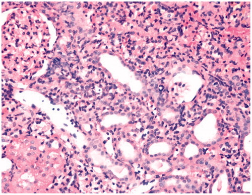 Figure 3. Minimal inflammation findings in kidney tissue of the pneumoperitoneum group (HE × 400).