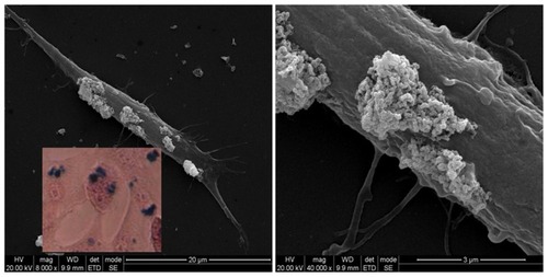 Figure 10 Scanning electron microscopy image of a single SH-SY5Y cell incubated for 24 hours with 10 μg/mL PLL-MNPs, showing the presence of MNP agglomerates (bright spots) on the cell membrane. Inset: Prussian blue staining on the same culture.Abbreviations: MNP, magnetic nanoparticle; PLL-MNP, poly-l-lysine-magnetic nanoparticle.