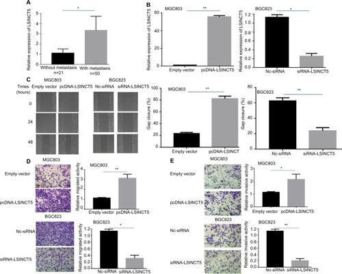 Figure 1 Effects of LSINCT5 on GC cell migration and invasion.Notes: (A) qRT-PCR analysis of the LSINCT5 expression levels in metastatic and nonmetastatic GC tissues. (B) qRT-PCR analysis of the LSINCT5 expression levels following the transfection of MGC803 cells with empty vector or pcDNA-LSINCT5 (left panel) or following the transfection of BGC823 cells with scrambled siRNA or si-LSINCT5 (right panel). (C) Wound healing assays were performed to investigate the migratory ability of GC cells. (D, E) Transwell assays were used to investigate changes in the migratory and invasive abilities of GC cells. All the experiments were performed in triplicate. Bars: SD; *P<0.05 and **P<0.01.Abbreviations: GC, gastric cancer; qRT-PCR, quantitative real-time polymerase chain reaction; NC, negative control.