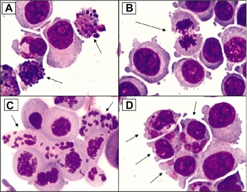 Figure 3 Examples of cellular alterations that accompany apoptosis (A), mitotic perturbation during anaphase (B), mitotic catastrophe with complete chromosome/spindle disruption (C), and abundant micronuclei formation associated with aneuploidy (D). Panels A, B, and D are examples of HCT-116 cells treated with 10 μM camptothecin. Panel C represents cells treated with 5 μM phenstatin (drug obtained through courtesy of Dr GR. Pettit, Arizona State University) (cytospin preparations of Giemsa-stained cells; ×100 oil objective lens)
