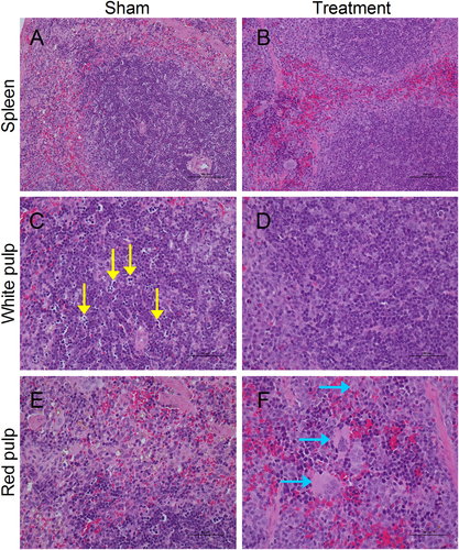 Fig. 5 C5a–C5aR blockade decreased spleen damage in hDPP4-transgenic mice.a–f Representative images of spleen tissue sections with hematoxylin and eosin (H&E) staining on day 7 after viral challenge. Numerous splenic cells presented necrosis or apoptosis, especially in the white pulp (yellow arrow). Mice with the anti-C5aR Ab treatment had less spleen damage with less splenic necrosis and apoptosis, and increased numbers of macrophages were detected in red pulp (blue arrow) (n = 5 per group)