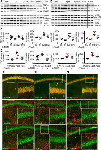 Figure 9 Oral application of L-TAMS attenuates the activation of NF-κB and upregulation of TNF-α and IL-1β in hippocampal CA1 region of ovariectomized and aged mice. (A and C) Representative Western blots (A) and statistical analysis (C) show the protein levels TNF-α, IL-1β, p-p65, total p65, p-IƘBα and IƘBα in hippocampi in indicated groups (n = 4 per group). (B and D) Representative Western blots (B) and statistical analysis (D) show the protein levels of TNF-α, IL-1β, p-p65, total p65, p-IƘBα and IƘBα in hippocampi of control (8 weeks), Aged and Aged + L-TAMS groups (n = 4–5 per group). The data were analyzed by one-way ANOVA with Tukey’s test. *P<0.05, **P<0.01, ***P<0.001, vs Sham (Sh); #P<0.05, ##P<0.01, vs OVX; $P<0.05, $$P<0.01, vs Aged. (E–G) Representative confocal images of the double immunofluorescence staining show that p-p65 (E) is mainly located in the nuclei of hippocampal CA1 neurons. TNF-α (F), and IL-1β (G) are mainly located in the cytoplasm of hippocampal CA1 neurons. Scale bar: 100 μm.