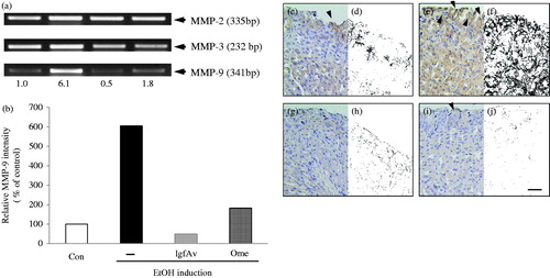 Figure 4. Matrix metalloproteinase (MMP)-9 protein expression is associated with gastroprotection by Aloe vera gel fraction against alcohol-induced acute gastric mucosal lesions. (a) mRNA expressions of MMP-2, -3 and -9 using reverse transcription-polymerase chain reaction (RT-PCR). Each tissue sample was homogenized, quantified and subjected to RT-PCR as described in the Materials and Methods section. (b) Relative band intensity is shown. (c, d) Sections of control, (e, f) only alcohol-treated, (g, h) alcohol-treated with lgfAv and (i, j) omeprazole-treated groups were immunohistochemically stained with MMP-9 antibody and visualized using secondary antibody. Dark blots (arrowheads) indicate MMP-9-responsive cells, which are secreted or bound with MMP-9 cells.