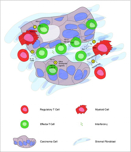 Figure 1. Human pancreatic cancer contains a complex immune infiltrate with both effector and regulatory elements. Based upon our findings, we hypothesize that carcinoma-specific effector CD8+ T cells present throughout the tumor produce interferon γ (IFNγ) that drives immunosuppressive counter-regulatory mechanisms by regulatory T cells (Tregs), myeloid cells, and carcinoma cells. Potential mechanisms of immunosuppression that may serve as therapeutic targets include: 1) inhibition of T-cell activation by stimulation of the negative checkpoint regulatory molecule programmed cell death 1 (PD-1) via binding to PD-1 ligands (PD-L1, PD-L2) expressed on cancer cells or myeloid cells; 2) malignant cell and myeloid cell production of the enzyme indoleamine 2,3-dioxygenase (IDO), which catalyzes the breakdown of tryptophan (Trp) to kynurenine (Kyn); 3) chemokine-mediated recruitment of regulatory T cells; 4) binding of additional T cell co-inhibitory receptors, such as T cell immunoglobulin mucin-3 (TIM-3), lymphocyte activation gene-3 (LAG-3) to ligands displayed by carcinoma cells; 5) production of IL-10 and transforming growth factor β (TGFβ) by Tregs.