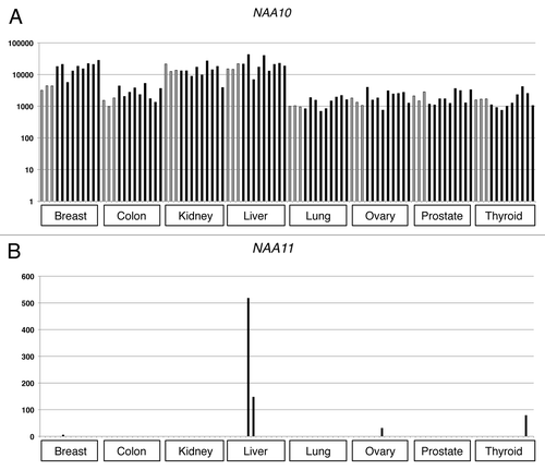 Figure 2 Expression analysis of NAA10 and NAA11 in cancerous tissues by Q-PCR. Y-axis: relative expression level of respective gene after normalizing to that of ACTB. Grey bars represent the gene expression levels obtained from normal tissues, whereas black bars refer to the expression levels detected in cancerous tissues. Br: breast; Co: colon; Ki: kidney; Lv: liver; Ln: lung; Ov: ovary; Pr: prostate; Ty: thyroid; N: normal tissues; T: cancer tissues. Numbers refer to the individual donors.