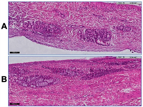 Figure 3 Histological images of the bovine nasal mucosa: (A) after 12-hr treatment with VPN-loaded TPGS-micelle ISG; (B) the normal (untreated) nasal mucosa.Abbreviations: VPN, vinpocetine; ISG, in situ gelling; TPGS, D-α-tocopherol polyethylene glycol 1000 succinate.