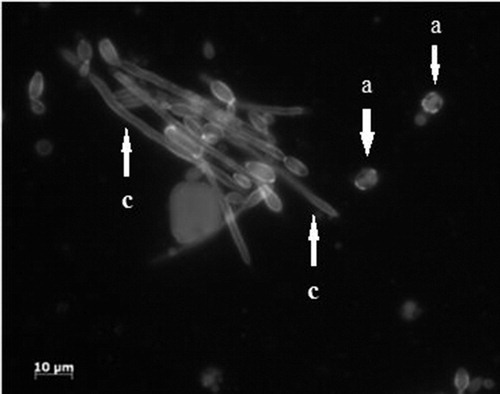 Figure 8. Confocal micrograph of Y. lipolytica MTLY40-2p. Yeast-like form (a); mycelial form (c).