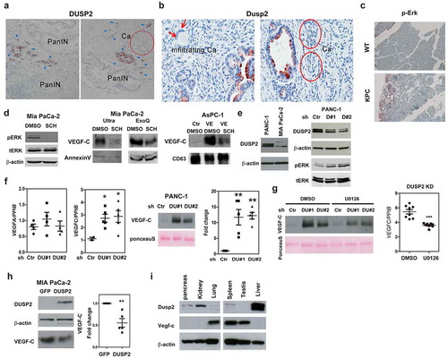 Figure 2. Inhibition of DUSP2 increases VEGF-C expression. (a) Representative pictures of DUSP2 immunostaining in pancreatic tumours. PanIN: pancreatic intraepithelial neoplasia, Ca: invasive carcinoma, arrowhead: non-tumour elements. (b) Representative pictures of DUSP2 immunostaining in KPC tumours. Arrows: infiltrating cancer cells; circles: carcinoma (Ca). (c) Representative immunohistochemical staining images show the expression of ERK1/2 phosphorylation in LSL -Trp53R172 H (WT) pancreas and KPC tumours. (d) Representative Western blots show the expression of phosphorylated ERK (left), EV-VEGF-C (middle) in MIA PaCa-2 cells treated without (DMSO) or with ERK inhibitor, SCH 772984 (1 μM, SCH) for 24 h. EVs were isolated by ultracentrifugation (Ultra) or ExoQuick-TC (ExoQ) exosome precipitation reagent. The right panel shows EV-VEGF-C in AsPC-1-Ctrl and AsPC-1-VEGF-C cells treated with DMSO or SCH 772984 (1 μM, SCH). EV in AsPC-1 was isolated by ExoQuick-TC. Annexin V and CD63 were used as markers of EVs in MIA PaCa-2 and AsPC-1 cells, respectively. (e) Representative image shows levels of DUSP2 in human pancreatic cancer cell lines PANC-1 and MIA PaCa-2 (left) and levels of DUSP2, total and phospho-ERK in control and DUSP2-KD PANC-1 cells (right). DU#1 and DU#2 indicate two stable clones of PANC-1 cells with DUSP2 knockdown. β-actin is a loading control. (f) VEGF-A and VEGF-C were measured in control and DUSP2-KD PANC-1 cells by RT-qPCR. Data represent mean and SEM of three experiments using different batches of cells (left). Representative image and the quantitative result (right) show the increase of secreted VEGF-C in DUSP2-KD PANC-1 cells. Ponceau S staining was employed to examine the equal loading of proteins. (g) RT-PCR and Western blotting for the detection of VEGF-C mRNA and secreted protein in control and DUSP2-KD PANC-1 cells treated with U0126 (10 μM). (h) Representative Western image shows levels of DUSP2 and VEGF-C in cells with or without transient expression of DUSP2 in MIA PaCa-2 cells. Secreted VEGF-C was quantified in control and DUSP2 transfected MIA PaCa-2 cells (right). (i) Inverse expression of DUSP2 and VEGF-C in mouse tissues. Various tissues from male BALB/c mice were collected and homogenized. Western blotting was performed to measure the expression of DUSP2 and VEGF-C. *P < 0.05; **P < 0.01; ***P < 0.001.