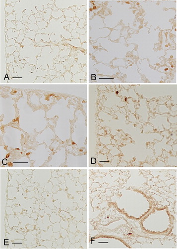 Figure 5. Immunohistochemical reaction for iNOS on lung slides obtained from smoke-exposed mice at 5 months from the start of experiments. A relevant number of iNOS positive macrophages (M1 type macrophages) is found in C57 Bl/6, DBA/2, and Lck knockout (B, C and, D, respectively), in which moderate or severe areas of emphysema are present at 7 months of cigarette smoke exposure. Only a negligible number of iNOS positive macrophages is present in ICR mice, or in p66 knockout animals (A, E and F) that do not develop emphysema after chronic cigarette smoke exposure. Scale bars = 50 µm.
