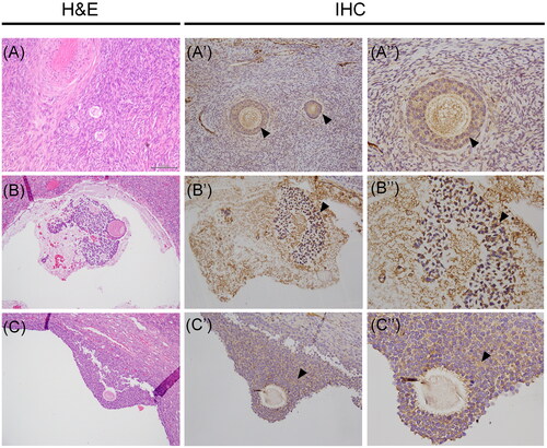 Figure 3. Vasn immunoreactivity in the human ovarian tissue. (A-B-C) Histological images stained with hematoxylin and eosin (H&E) of human ovarian tissue. Vasn expression was observed on the surface of pregranulosa cells (A’-A’’, arrowhead) and it was also maintained during follicle maturation at the surface of granulosa cells (B’-B’’, arrowhead). High Vasn expression was also present on the surface of cumulus oophorus cells surrounding the oocyte (C’-C’’, arrowhead). Scale bar= 200 µm.