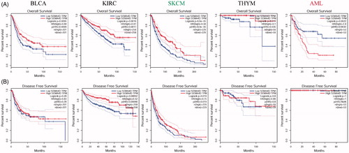 Figure 2. Kaplan-Meier survival curves of patients with the high and low Sema4D expression analysed by GEPIA. Overall survival (A) and disease free survival (B) in bladder cancer (BLCA), kidney clear cell renal cancer (KIRC), melanoma (SKCM), thymoma (THYM), and acute myeloid leukaemia (AML). 95% confidence interval information was added as dotted line. The hazards ratio (HR) was calculated based on Cox PH Model. Log-rank test was used to significance analysis.