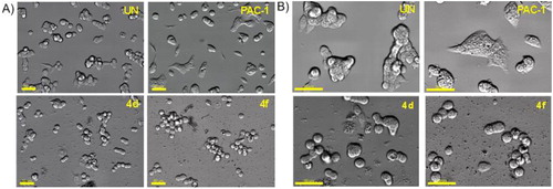 Figure 6. Morphology changes of cells treated with representative compounds 4d and 4f. U937 5 × 105 cells/well seeding (2.5 × 105 cells/ml, 2 ml/well, six well) were incubated for 24 h, then compounds 4a, 4f or PAC-1 (50 μM) were added and incubated further for 24 h. The cells were then photographed using an Imaging Device: Zeiss, Celldiscoverer7 with ×40 lens, scale bar: 20 µm (A) and 50 µm (B). UN: untreated.