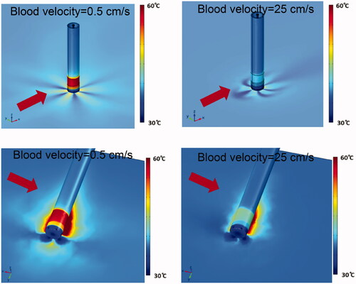 Figure 8. Catheter and tissue surface temperature (30 ml/min irrigation flow rate). Results are shown for perpendicular catheter orientation (upper images) and for parallel orientation (lower images), as well as for blood flow velocities of 0.5 cm/s and 25 cm/s as indicated. Direction of blood flow is indicated by red arrows.