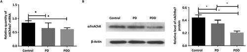 Figure 2. Expression of nAChRα7 in different groups. (A) Relative level of nAChRα7 mRNA detected by RT-qPCR. (B) and (C) Relative expression of nAChRα7 protein detected by Western Blot. β-actin was as an internal control. *p < 0.05.