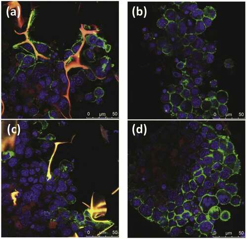 Figure 3. Confocal microscopy images of chondrogenic differentiated hMSCs on (a and c) SF/CS-Gl-Ch scaffolds and (b and d) pellet culture, where red represents immunofluorescence of Col II in a-b and Acan in c-d. Green fluorescence represents β-actin stained by phalloidin and blue corresponds to nucleus stained by Hoechst 33258 [Citation47].