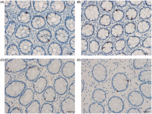Figure 2. PYY cells in the colon of a Thai control (A), in a Thai IBS-D patient (B), in a Norwegian control (C), and in a Norwegian IBS patient (D).