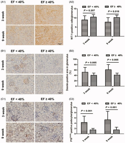 Figure 4. Representative podocyte injury in myocardial infarction rats at 3 and 9 weeks. (A1) Immunohistochemical staining for WT-1-positive podocytes at 3 and 9 weeks. (A2) The average number of WT-1-positive podocytes per glomerulus at 3 and 9 weeks. (B1) Immunohistochemical staining for desmin at 3 and 9 weeks. (B2) The relative percentage of desmin-stained area of total glomerular area in the glomerulus at 3 and 9 weeks. (C1) Immunohistochemical staining for p16ink4a at 3 and 9 weeks. (C2) The average number of p16ink4a-positive podocytes per glomerulus at 3 and 9 weeks. EF: ejection fraction; WT-1: Wilms’ tumor-1; original magnification, ×200.