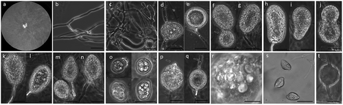 Figure 1. Pythiogeton manoomin. (a), Colony on PDA; (b–c), hyphae and appressoria (arrows) on RSA; (d–e), sporangia, terminal or intercalary and short distance from the end of supporting hyphae; (f–g), globose (arrow) and ellipsoid sporangia, (h–i), reniform sporangia, (j), bilobate sporangia, (k–l), pyriform sporangia, (m–n), globose (arrow) and ovoid sporangia; (o), chlamydospores, (p–q), sporangia initiating formation of the discharge tube (arrowheads), (r), formation of zoospores from a protoplasm mass, and, (s), discharged zoospores; (t), empty sporangia, showing empty discharge tubes (arrows). Scale bars = 20 μM.