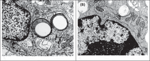 Figure 3. TEM electron micrograph of RAW 264.7 macrophage control cells upon exposure to (A) 1 ppm tyramine and (B) 1 ppm spermidine shows early apoptosis with apoptotic bodies and intact mitochondria.