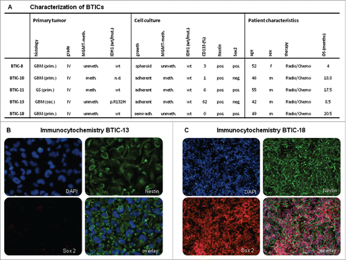Figure 1. Characterization of BTICs. (A) Cell culture and patient characteristics of the BTICs used in this study. All BTICs were primary BTICs of glioblastoma. MGMT methylation status did not change for most BTIC cell lines after culturing. All BTICs were Nestin positive indicating neurogenesis. (B and C) Immunocytochemistry of BTIC-13 and BTIC-18. These cell lines were chosen exemplarily due to their different endogenous TGF-β2 expression (see Fig. 6). Both were Nestin positive; however, Sox2, a neural stem cell marker, was expressed only in cell line BTIC-18.