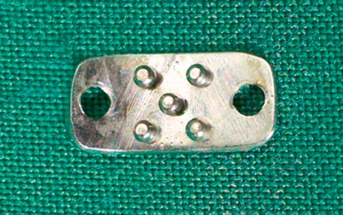 Figure 1. Plate with pegged undersurface.