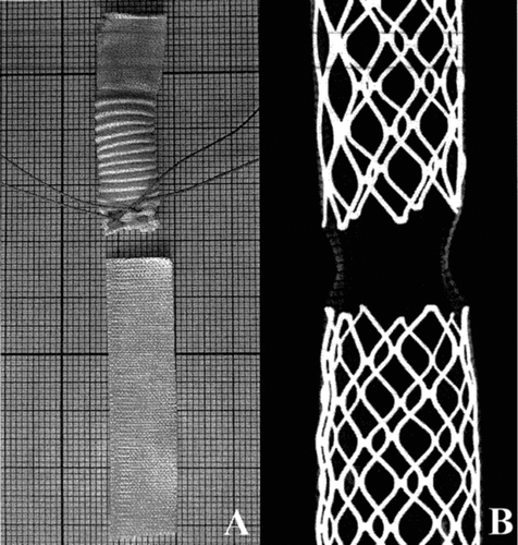 Figure 3 Weft-knitted polyester employed in the construction of the stent-graft, crimped in Module A with a distal suture to create a constriction to firmly hold the distal module (A1) and non crimped in Module B (A2); this polyester knit holds characteristics of dimensionnal adaptability without structural change as evidenced in X-rays (Faxitron) (B).