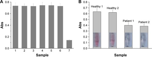 Figure 6 (A) Selectivity of the method: PBS blank (bar 1), 10 ng/mL thrombin (bar 2), 10 ng/mL trypsin (bar 3), 50 ng/mL hemoglobin (bar 4), 50 ng/mL BSA (bar 5), 200 µM AA (bar 6), and 0.8 ng/mL PSA (bar 7). (B) Assays of PSA in the serums of healthy donors and prostate patients.Abbreviations: AA, ascorbic acid; BSA, bovine serum albumin; PBS, phosphate-buffered saline; PSA, prostate-specific antigen.