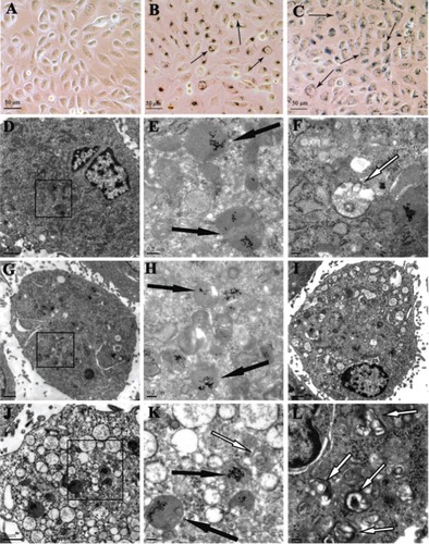 Figure 3 The GNP uptake and intracellular localization (A–C) and TEM images of normoxic (D–F) and hypoxic HK-2 cells (G–L) after 24 hour incubation with the 5-nm 50 nM GNPs.Notes: Representative bright field images of the HK-2 cells untreated (A) or treated with the 5-nm 50 nM GNPs under normoxic (B) and hypoxic conditions (C). The GNPs form distinct, dark aggregates in the cells (black short arrows). GNPs were localized in lysosomes (black long arrows) and autophagosomes (white long arrows) (E), (H), and (K) represents the enlargement of black square area indicated in (D), (G), and (J), respectively.Abbreviations: GNP, gold nanoparticles; TEM, transmission electron microscopy.