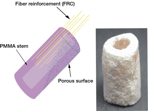 Figure 1. Schematic drawing representing the SPF implant, with surface porosity and E-glass fiber-reinforced core. Macroscopic picture of the implant.