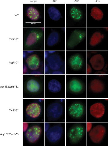 Figure 4. Mutant ADNP (mis)localization in the nucleus.HEK293T cells were transiently transfected with GFP-tagged hADNP. Cells were fixed and co-localization of ADNP with heterochromatin was analyzed by immunolabeling for HP1α, a well-established heterochromatin marker. Nucleic DNA with percentromeric heterochromatin foci was stained with DAPI (blue), ADNP was visualized using the GFP-tag (green) inherent to the construct and HP1α (red) was stained using anti-HP1α antibody. Co-localization of ADNP with HP1α can be observed as a yellow signal in the composite image. The signal for WT ADNP is clearly enriched at pericentromeric heterochromatin. Similar data are obtained for ADNP mutants Tyr936* and Arg1023Serfs*3. The cytoplasm-stalling p.Tyr719* mutation was used as a negative control. While the protein lacking the HP1α interaction motif (p.Arg730*) and the mutant p.Asn832Lysfs*81 still co-localize with HP1, specific enrichment at pericentromeric heterochromatin seems partially lost.