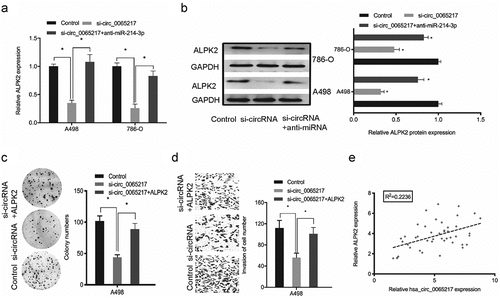 Figure 8. Oncogenic hsa_circ_0065217/miR-214-3p/ALPK2 signaling in RCC cells. (a, b) ALPK2 expression levels in RCC cells transfected with si-circ_0065217 or miR-214-3p inhibitors. (c, d) Forced ALPK2 expression reversed hsa_circ_0065217 silencing effects on RCC cells colony formation and invasion. (e) High ALPK2 levels were positively correlated with hsa_circ_0065217 levels in RCC tissue. *P < 0.05