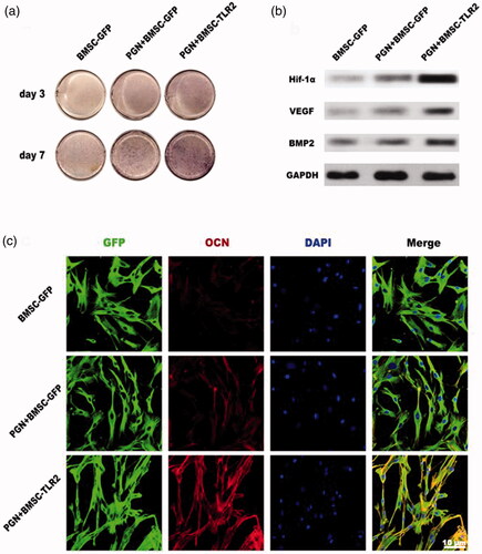 Figure 3. Effects of PGN on regulating TLR2-modified BMSCs osteogenic differentiation (a) ALP staining. (b) The expression of Hif-1α, VEGF, BMP-2 was detected using Western blotting. (c) OCN expression was detected using immunofluorescence staining.