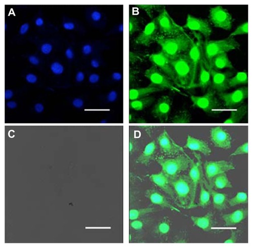 Figure 6 Confocal laser scanning micrographs of B-CPAP cells treated with fluorescein-labeled PEGylated unilamellar liposomes after 6 hours of incubation. (A) Hoechst filter, (B) FITC filter, (C) transmission mode, and (D) overlay.Note: Bar 30 μm.Citation51Abbreviations: FITC, fluorescein isothiocyanate; PEG, poly(ethylene glycol).