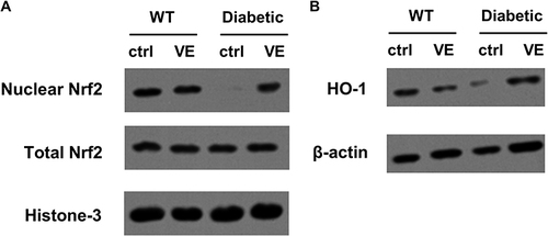 Figure 6 Effects of vitamin E (VE) on nuclear factor-erythroid factor 2-related factor 2 (Nrf2) activation and heme oxygenase-1 (HO-1) expression. The maternal liver tissues were harvested on birth. (A) Western blot analysis of total and nuclear protein levels of Nrf2. (B) Western blot analysis of HO-1 protein level.