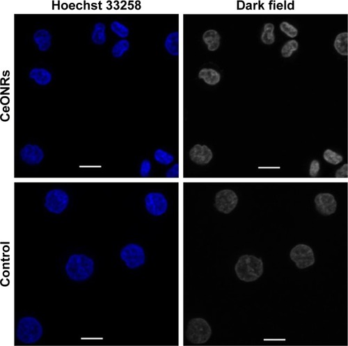 Figure 7 CLSM images of HepG2 cultured with 40 μg/mL CeONRs, and the control group cultured with the same amount of PBS. Scale bar: 5 μm.Abbreviations: CLSM, confocal laser scanning microscopy; CeONR, CeO2 nanorod; PBS, phosphate-buffered saline.